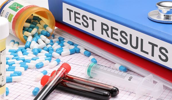 Test Results